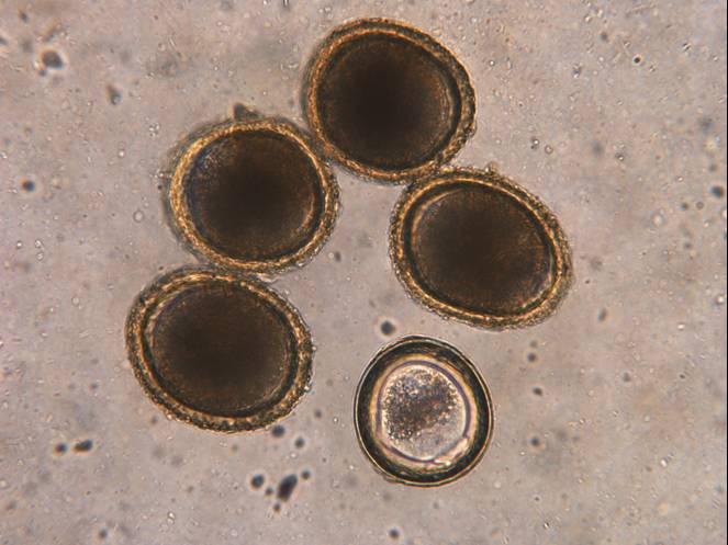 Roundworm eggs